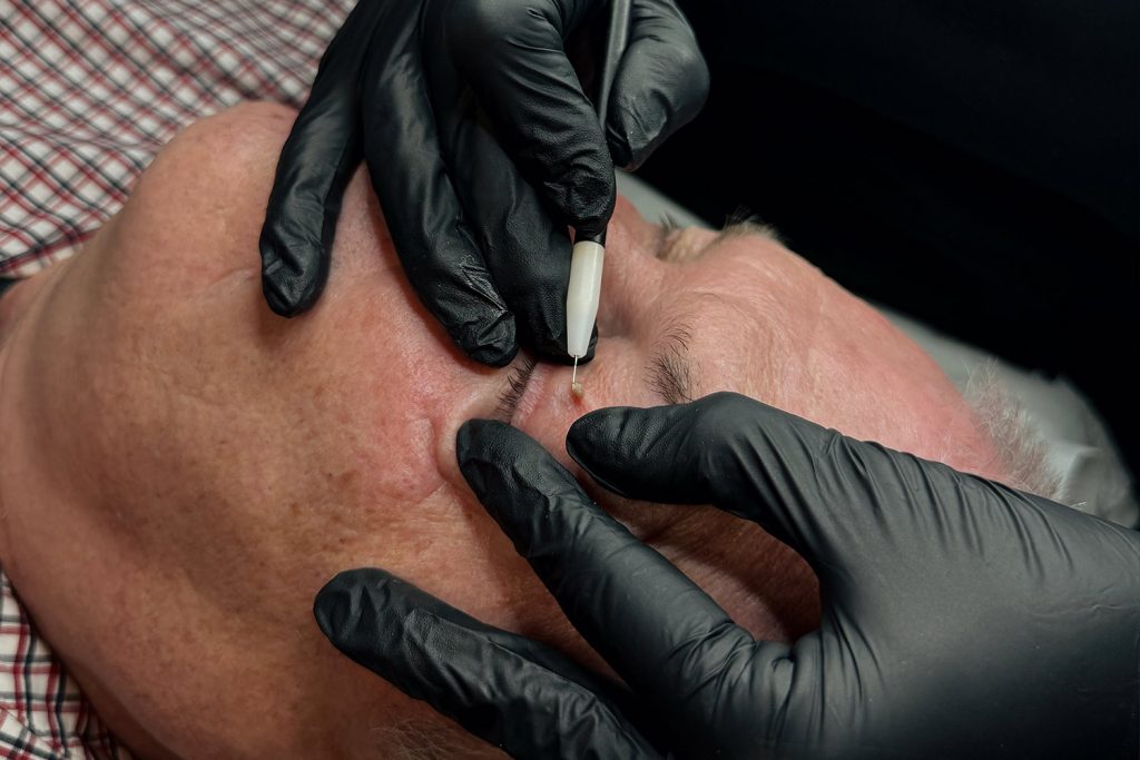 Advanced electrolysis
